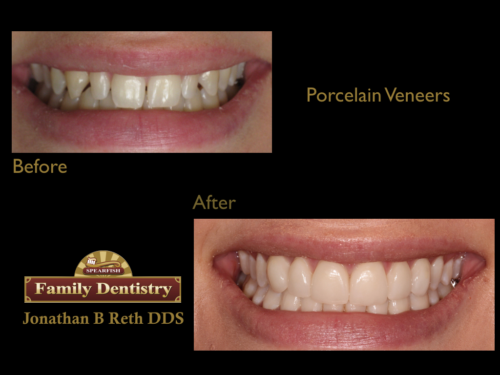 Our patient pictured above.