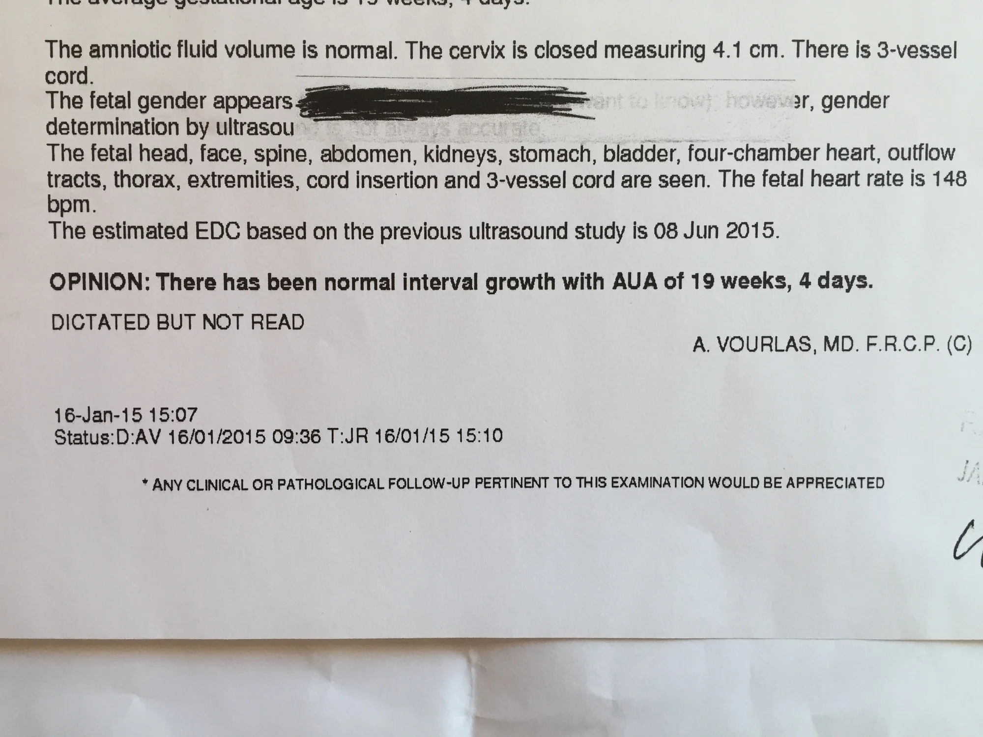 Do you know if it's Boy or Girl?