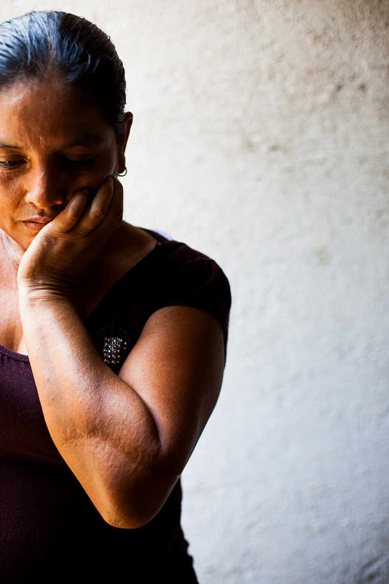 Elubia Luna Tizol shielded her head with her arm during a murder attempt with a machete by her brother. He served in the Guatemalan Civil War and suffers from post traumatic stress disorder. 