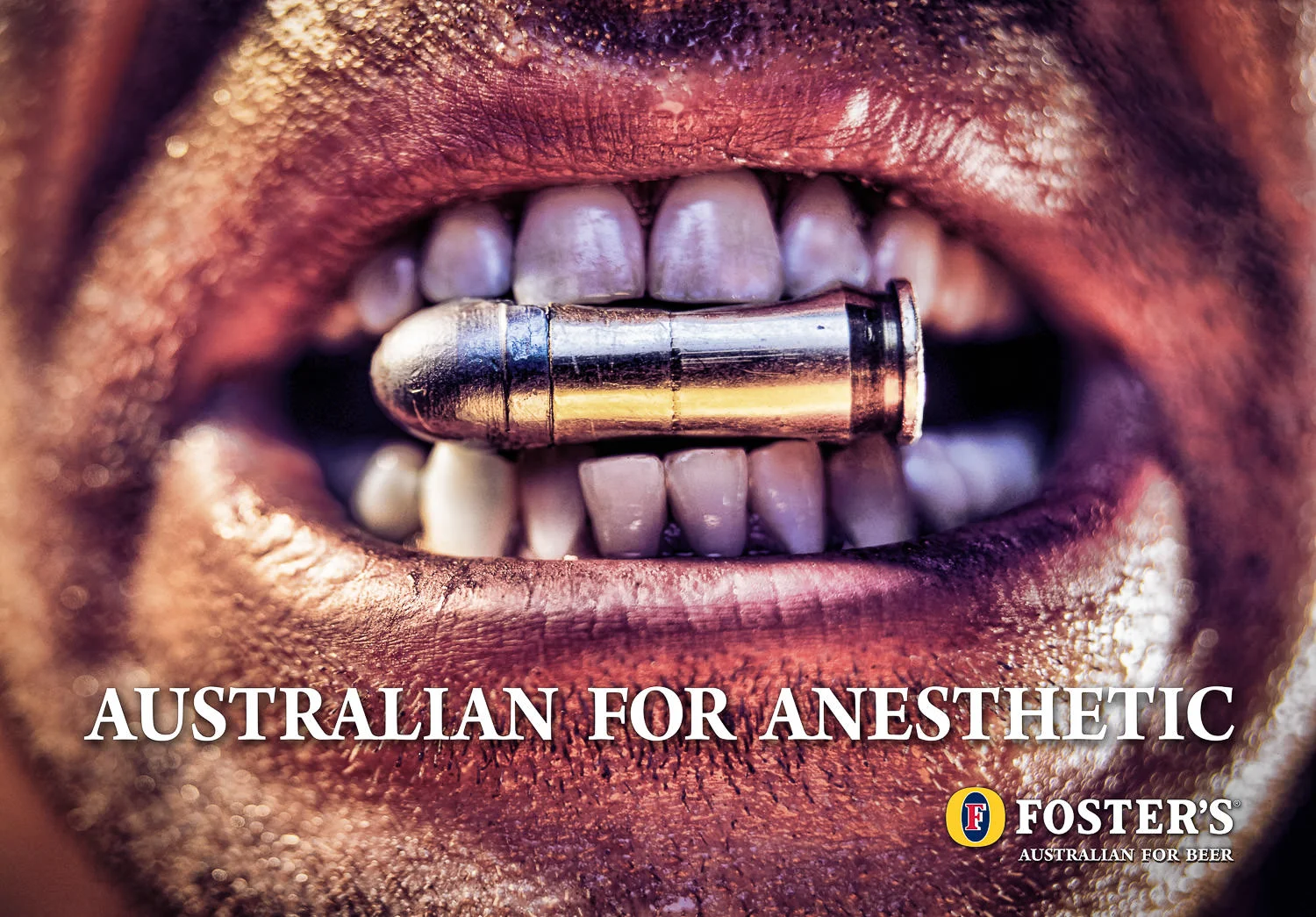 AUSTRALIAN FOR ANESTHETIC FOSTER'S BEER