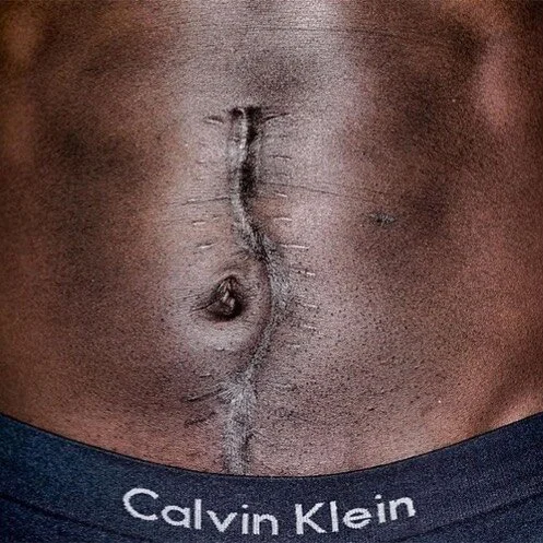 Repost from @kennylarkinofficial
•
The scars of racism are just as profound as the scars I suffered when I was almost murdered in 1994 by gunshot. These physical scars and emotional/mental scars of racism last a lifetime.
Racism and violence ar