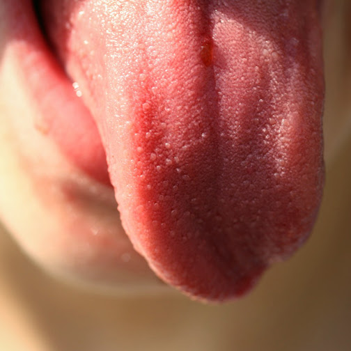 What does your tongue say about your health?