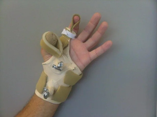 Index and Thumb Combination Flexion Splint