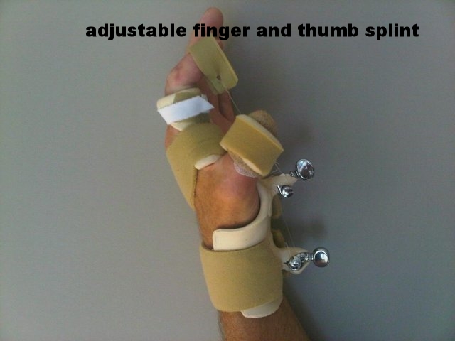 Index and Thumb Combination Flexion Splint