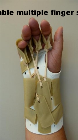 Forearm Based MP Flexion Splint