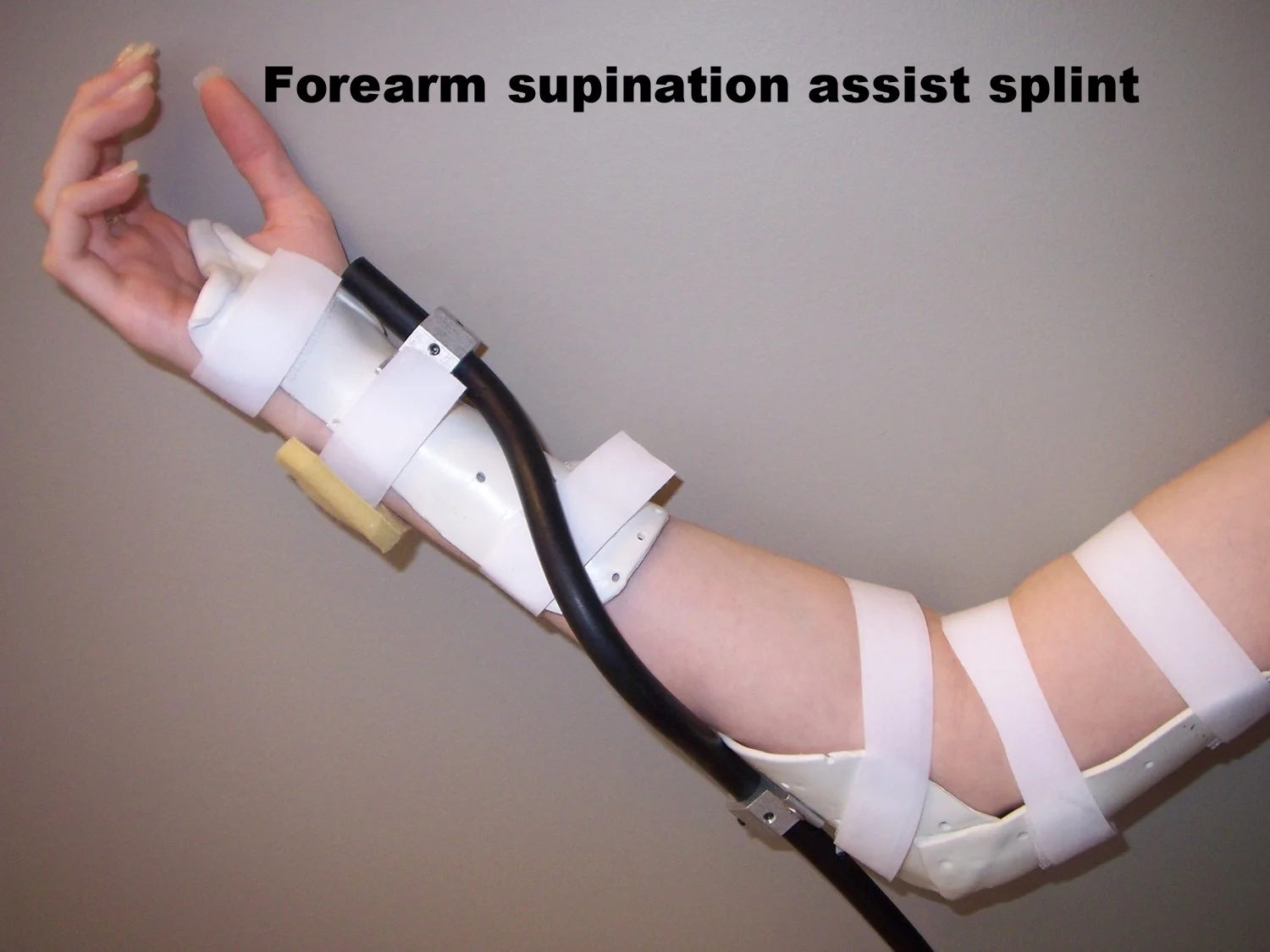 Rolyan Supination Splint