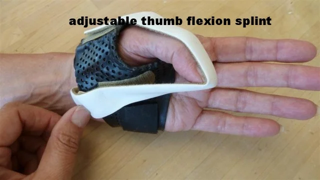Composite Flexion Thumb Splint