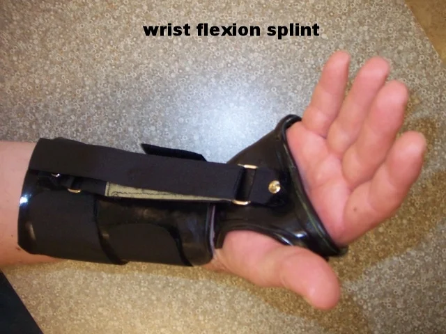 Wrist Flexion Splint