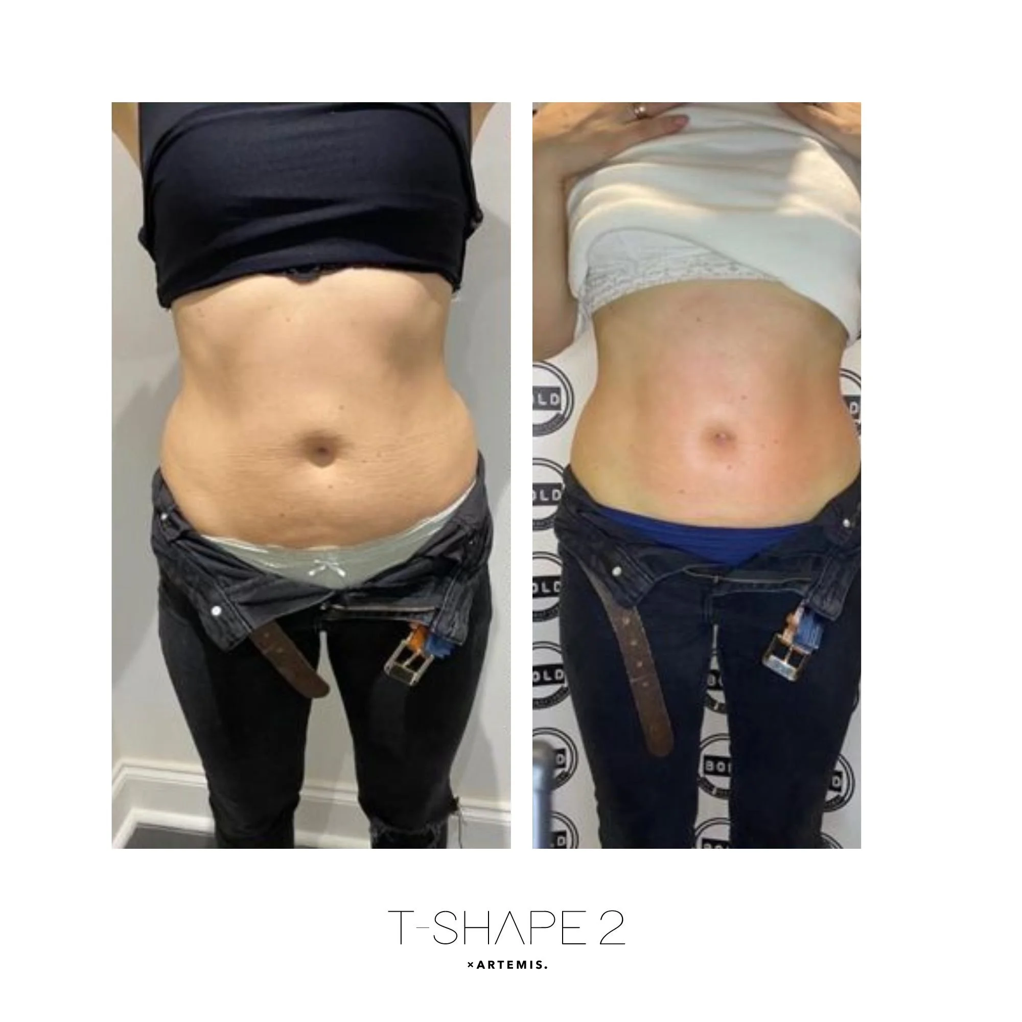 Abs_5.jpg