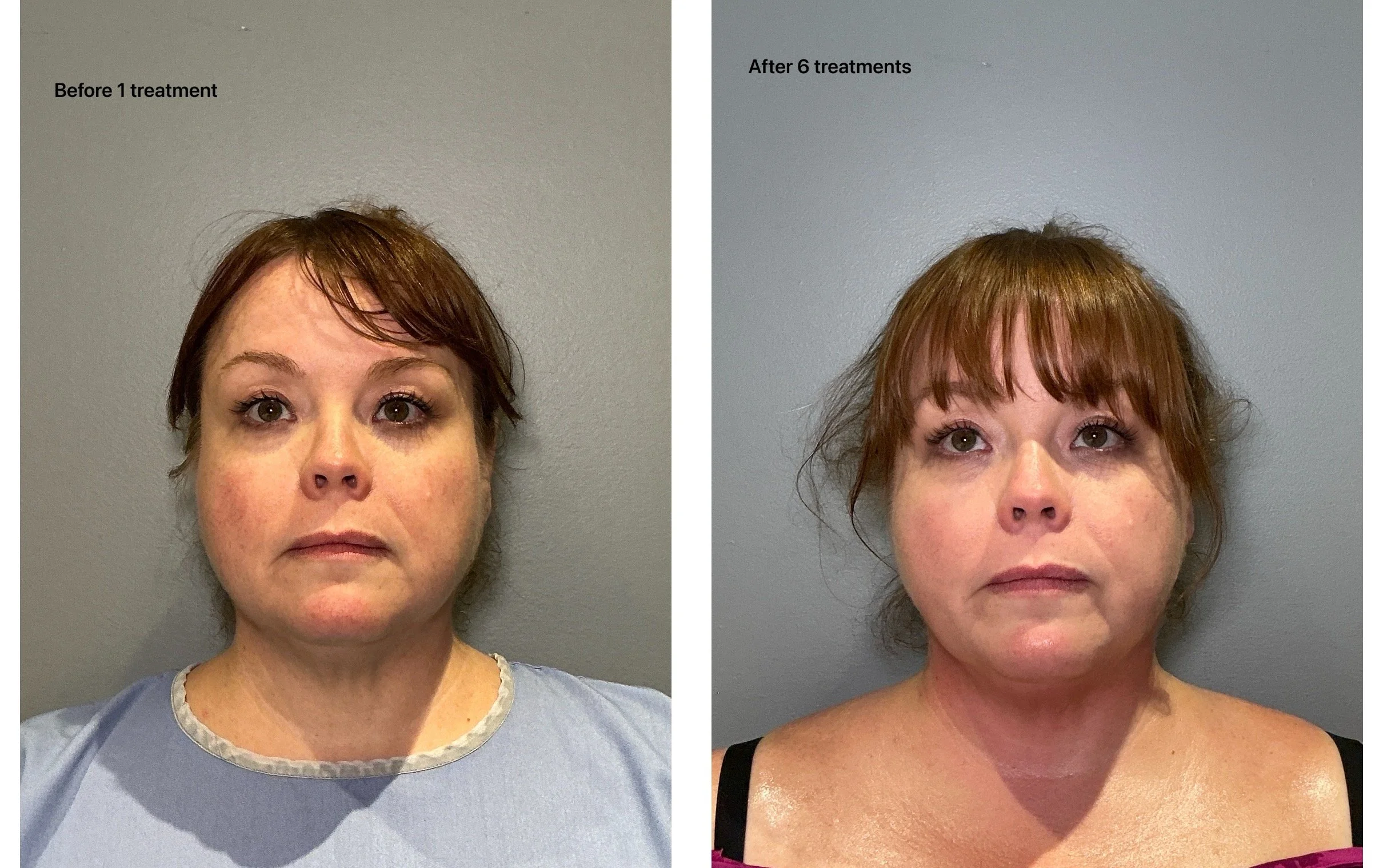 6 treatments copy.JPG