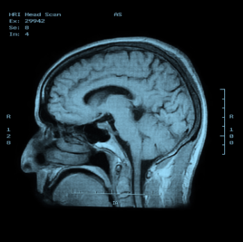 our brains rewire themselves according to our habits. an x-ray of the living tissue of a human brain.