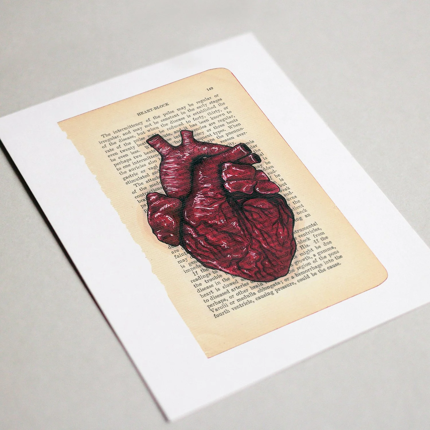 Heart-Block (Print)