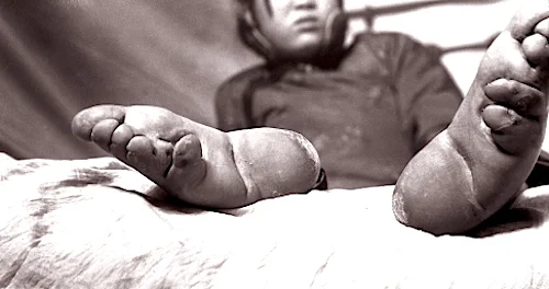 We Were Doomed From the 13th Century: Chinese Footbinding & The Effects on Later Generations 