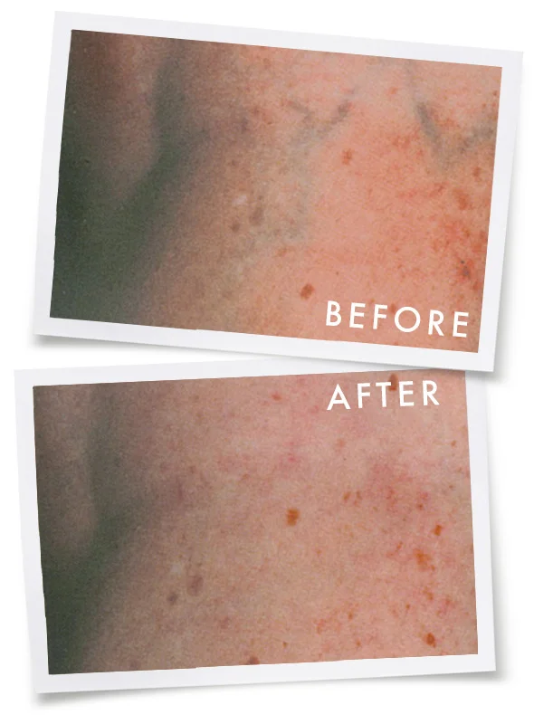 Before & After