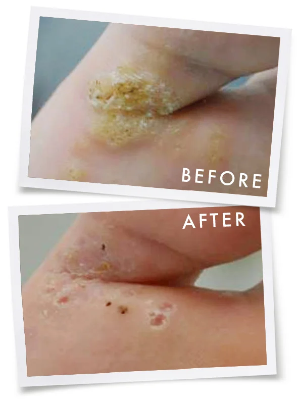 Before & After