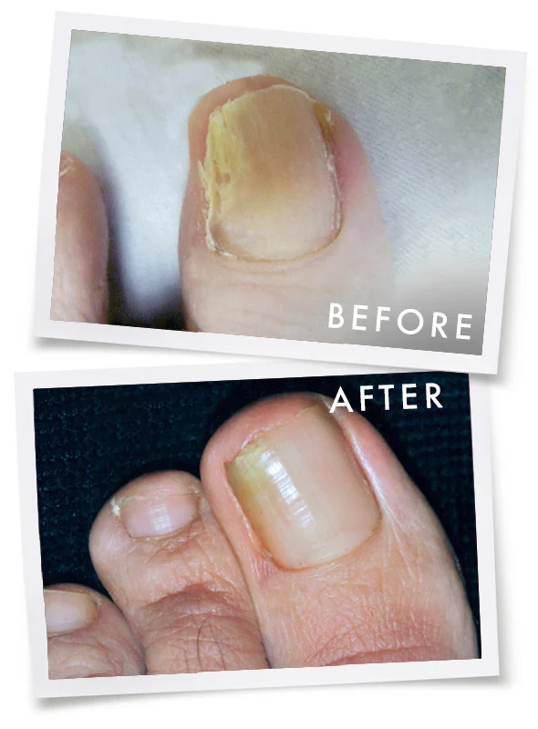 Before & After