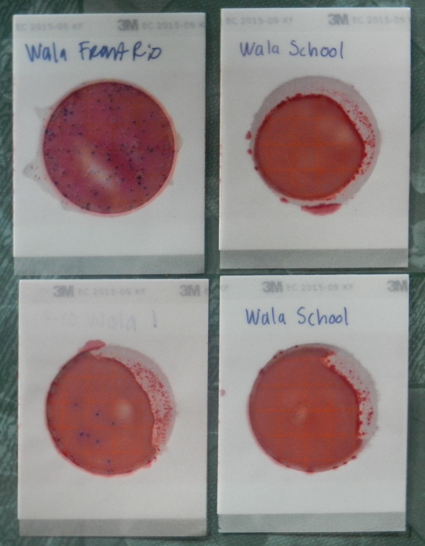 Water tests from Wala. All the dots are bacterial colonies from fecal contamination.