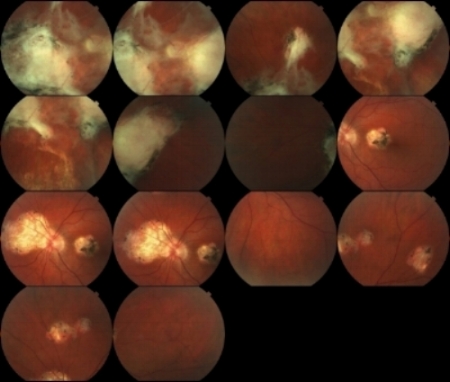 Patrick+Anderson's+retinal+scans.jpeg