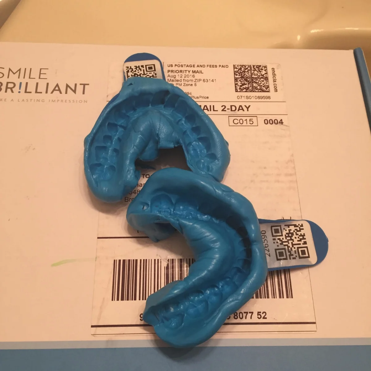 Teeth molds after creating impressions. 