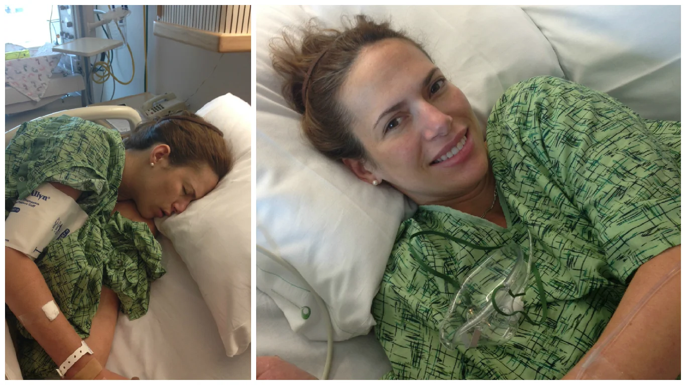 Left: Pre-epidural; Right: Post-epidural.