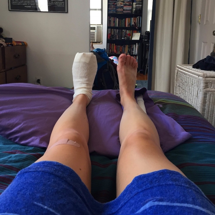 Here is my foot being held hostage post-surgery. I was in Brooklyn the morning-of, then went to Queens for the procedure, and Hell's Kitchen for my next stay in the city. I lived in a 5th floor walk-up on an air mattress that deflated overnight. :) 