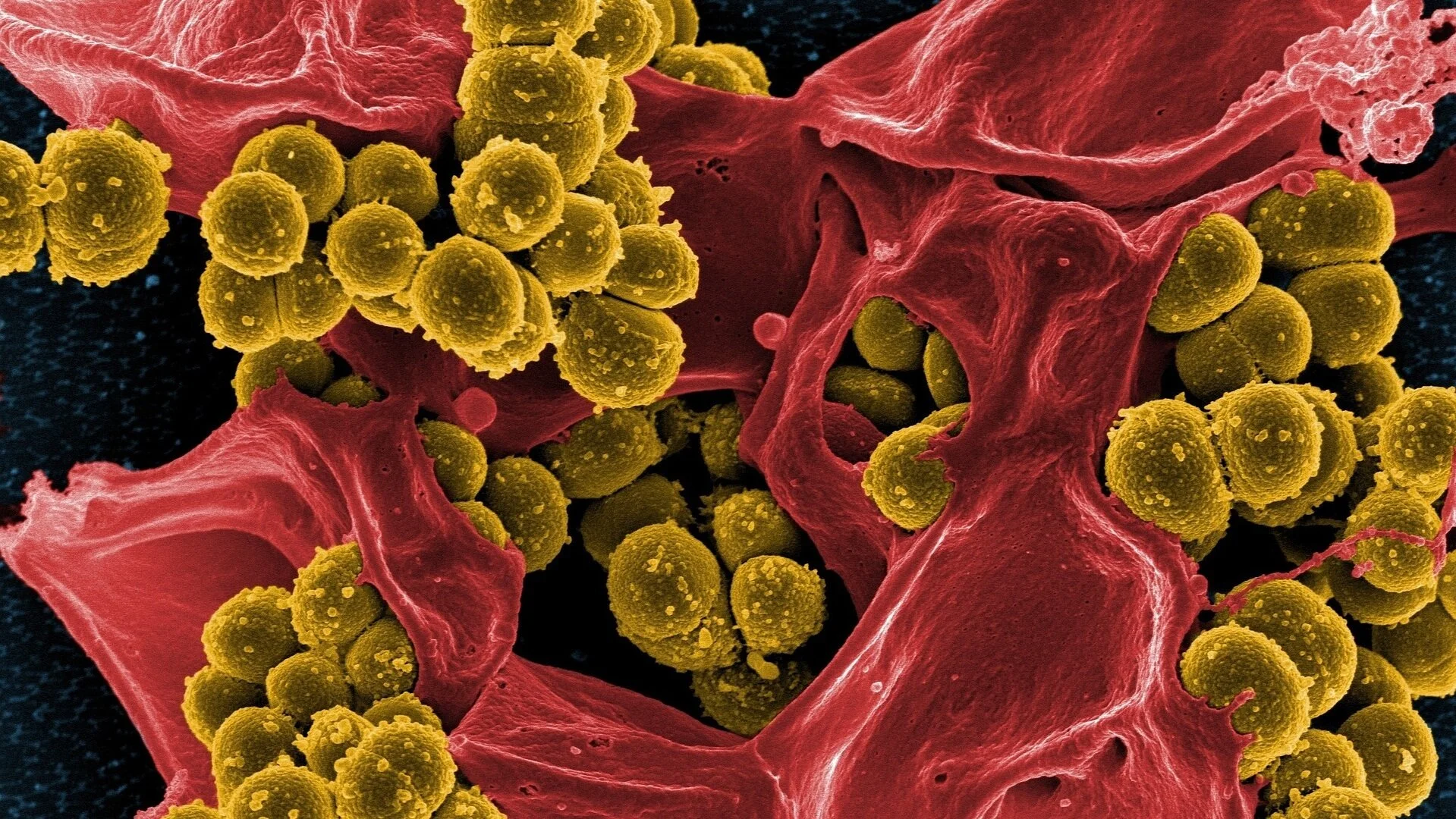 bacteria-808158_1920.jpg