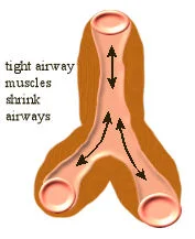 My Child Was Prescribed Albuterol What Should I Know About It Plateau Pediatrics