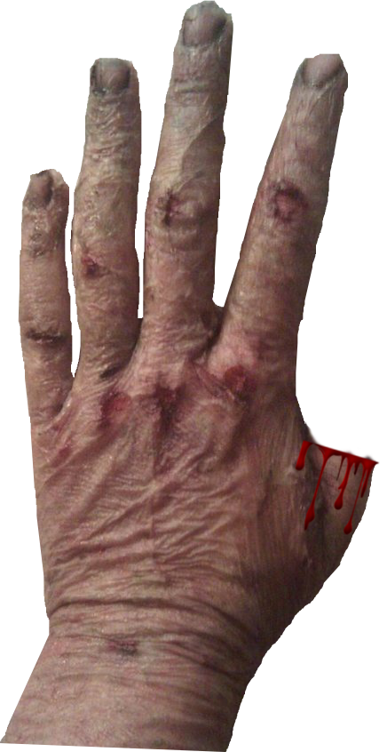 4 Scars