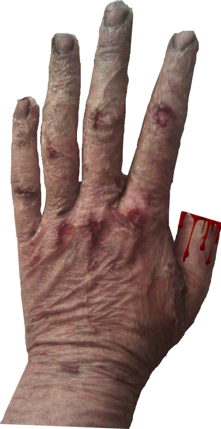 4 1/2 Scars