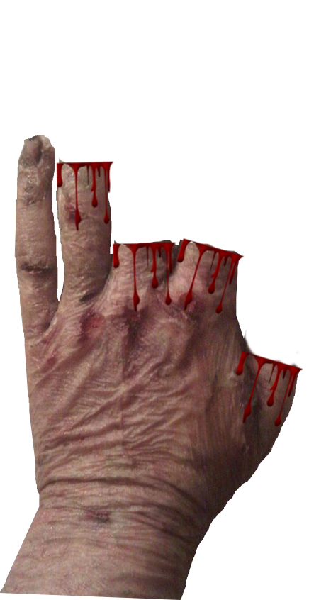 1.5 Scars