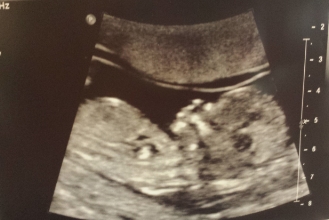 Baby #2's glamour shot