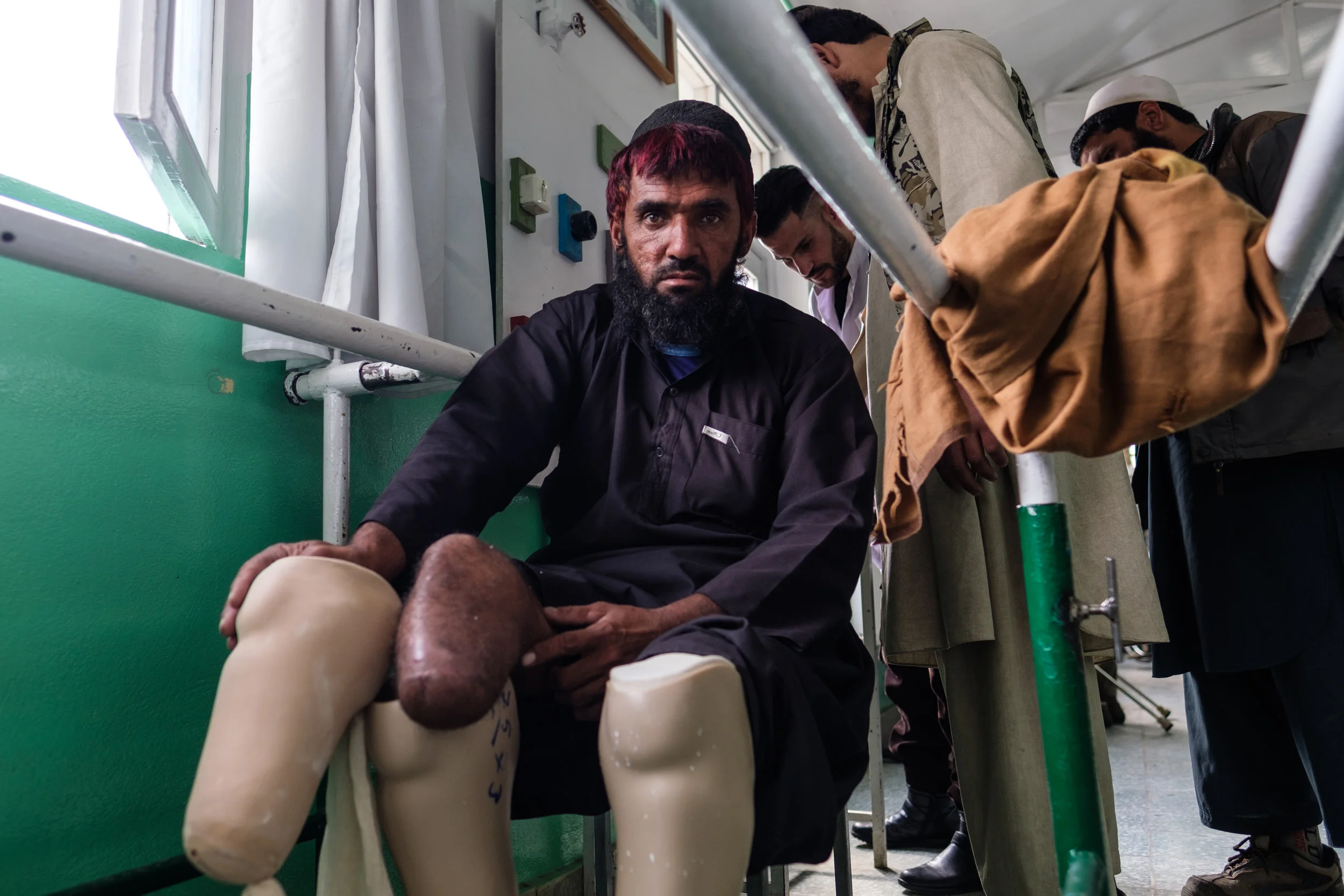 Being fitted for leg prosthetics at the ICRC prosthesis clinic in Kabul. 2018.