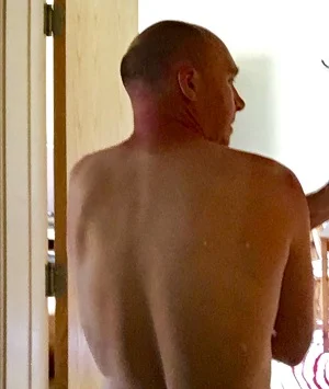 Seems I managed to burn myself Must put sunblock on next time