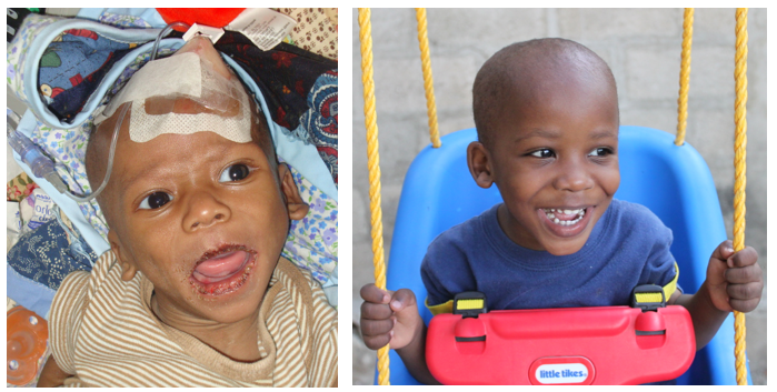 Comerson then and now!