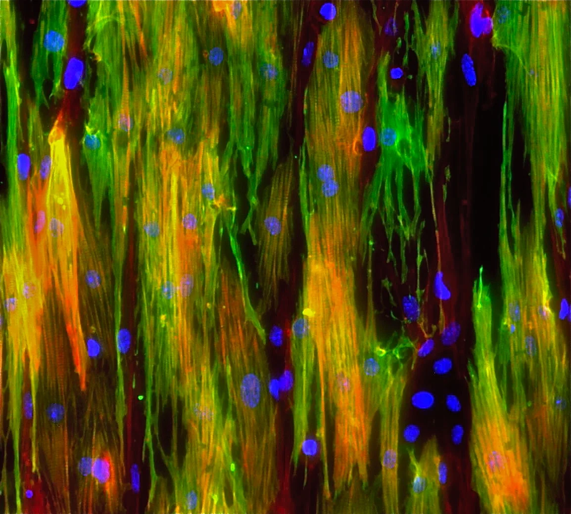 CIRM-ALIGNED-NNCM-300DPI.jpg