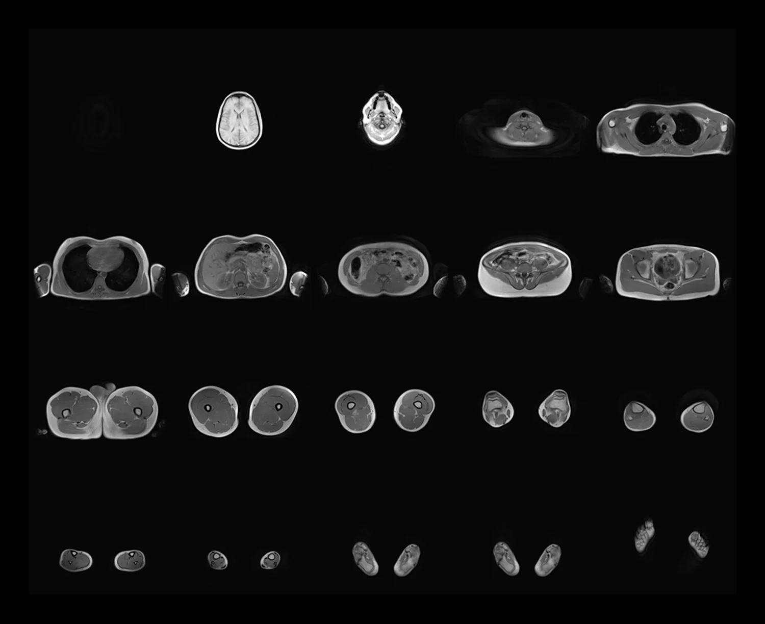 MRi Life Drawing-axial-small.jpg