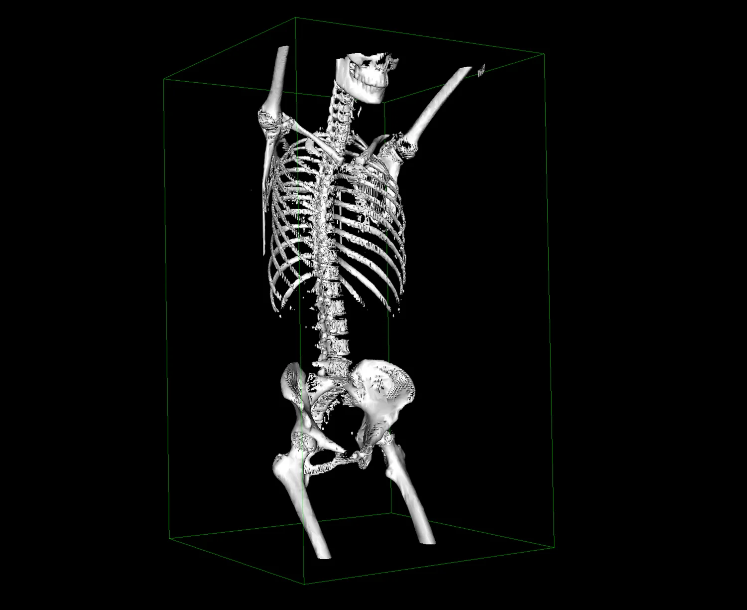 fullskeleton.jpg