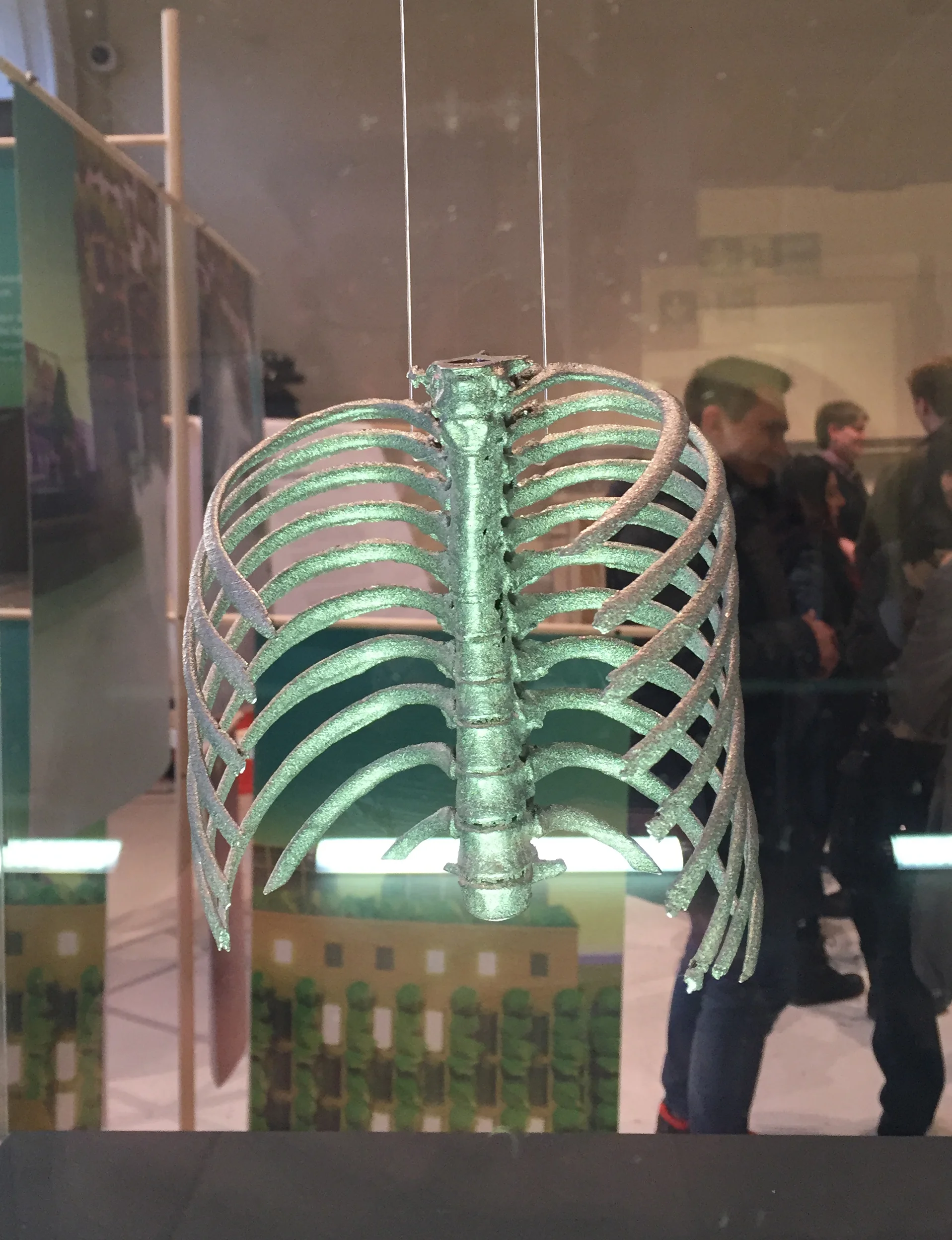 Titanium Ribs.jpg