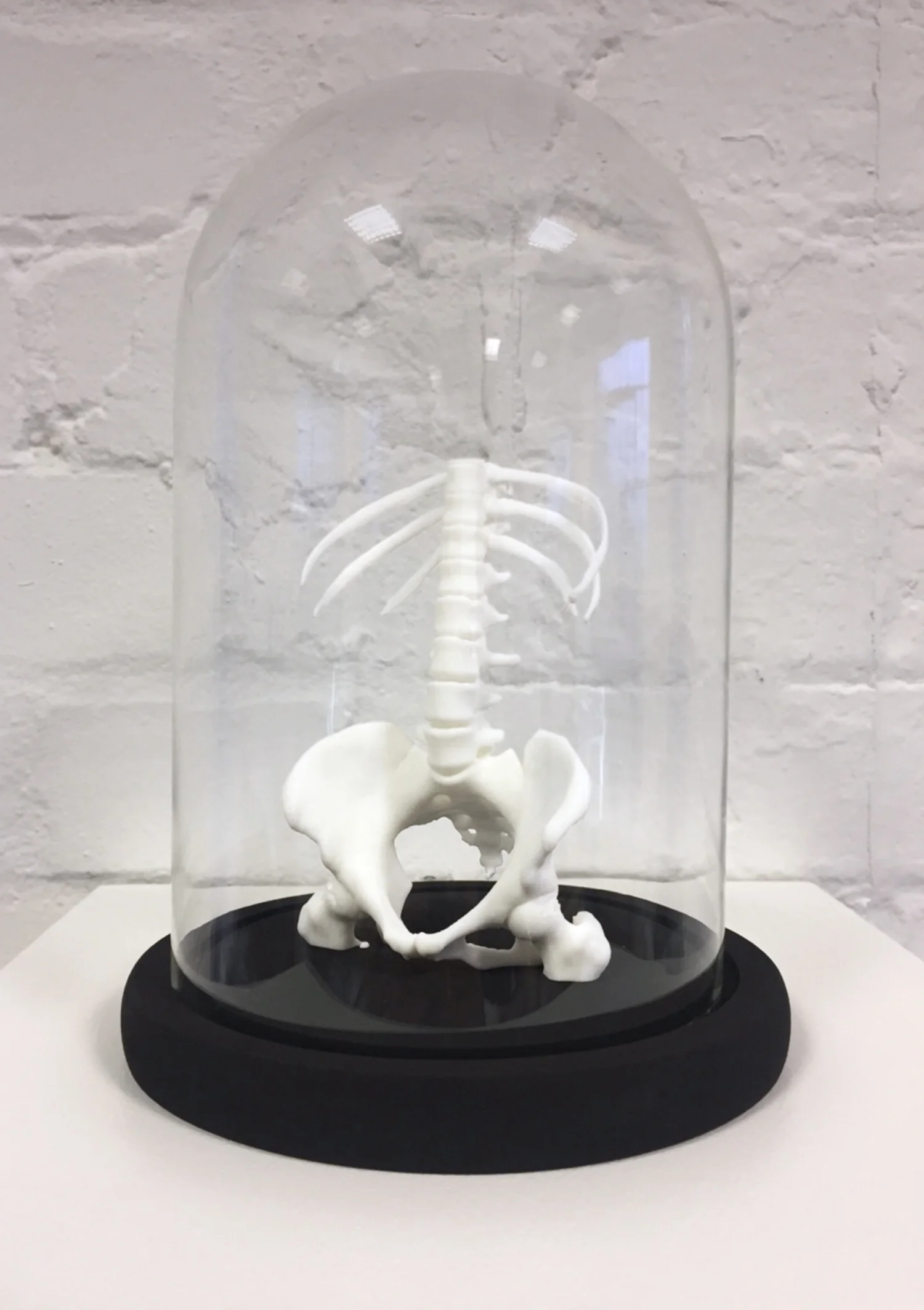 3. Pelvis and Spine in Bell Jar.jpg