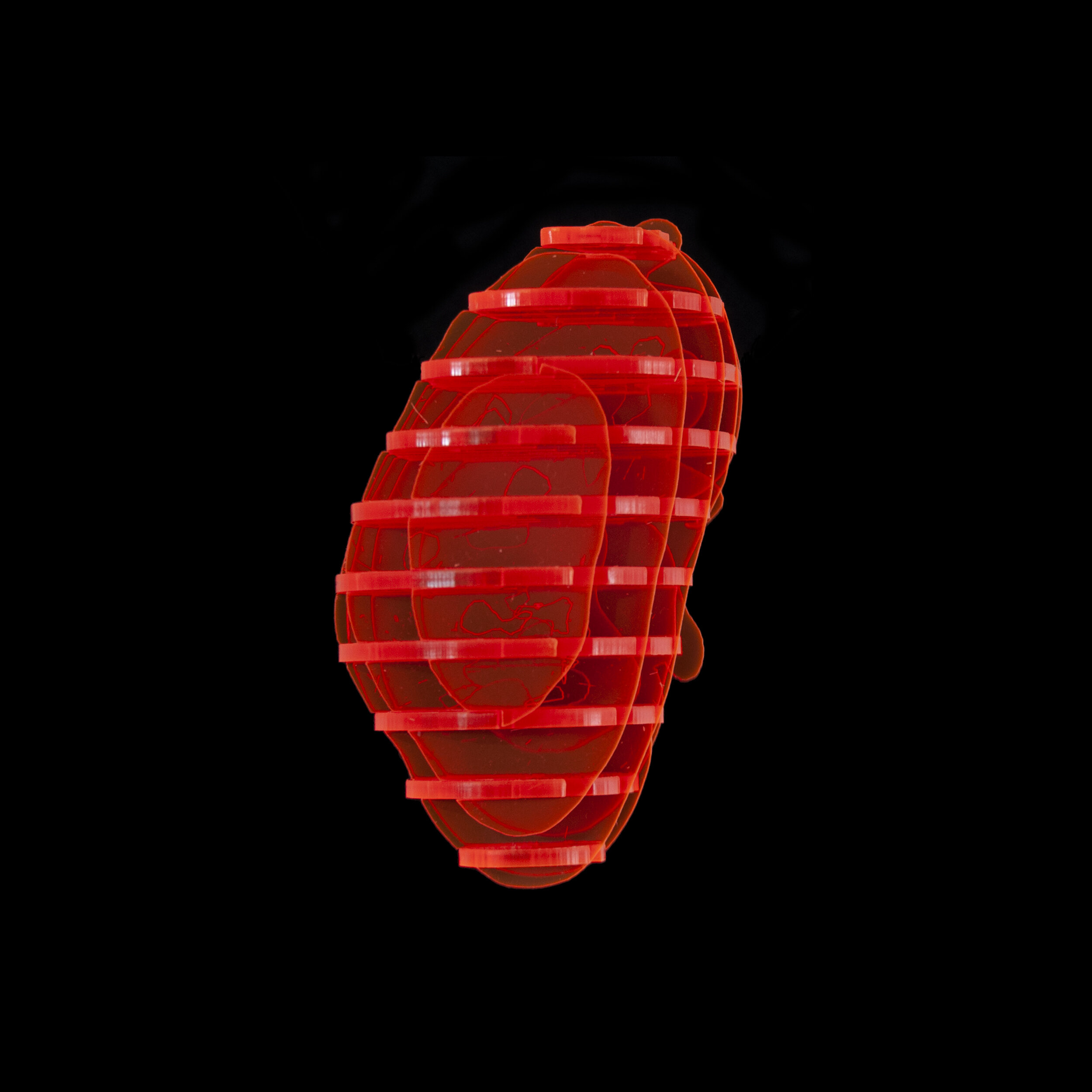 Kidney Plastic Right .jpg