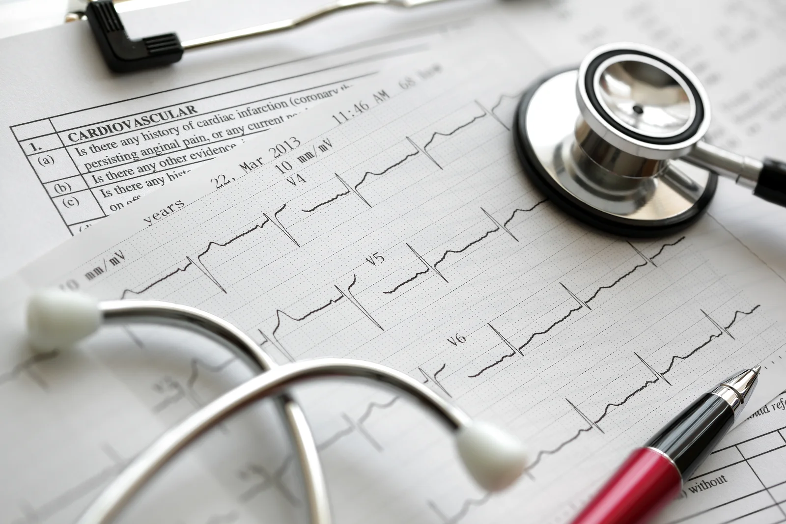 ECG Diagnosis and Arrhythmia Managment: Get the Rhythm!
