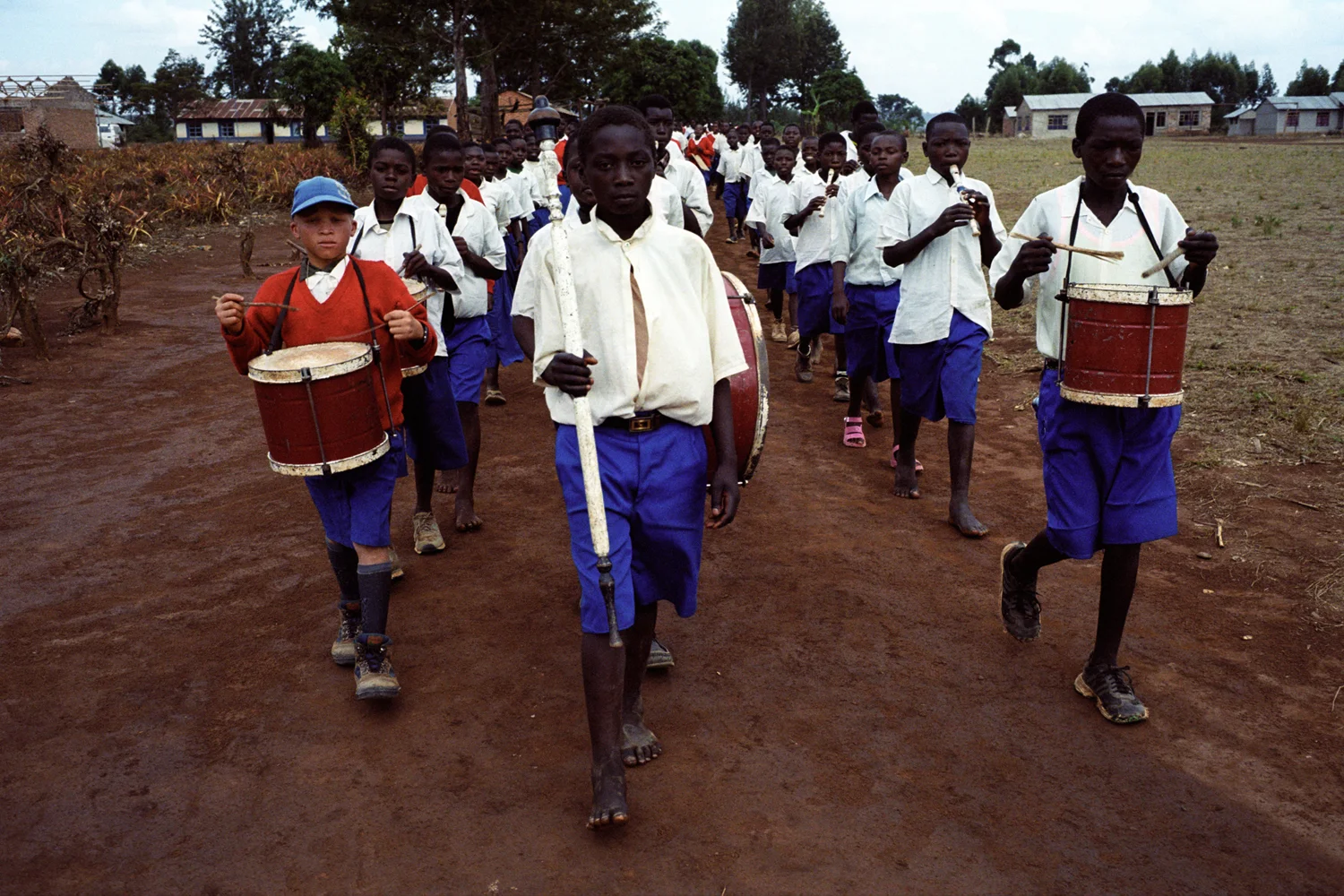 Adolfu Tukano marches with the school band in the afternoon when the sun is less strong. People with albinism have no pigmentation in their skin so are unprotected from the sun's UV rays. Unless they are very careful, skin cancer is an inevitability. Adolfu and his sister Juliana are the only children with albinism at their school. Lugolofu Primary School, Mufindi District, Tanzania.