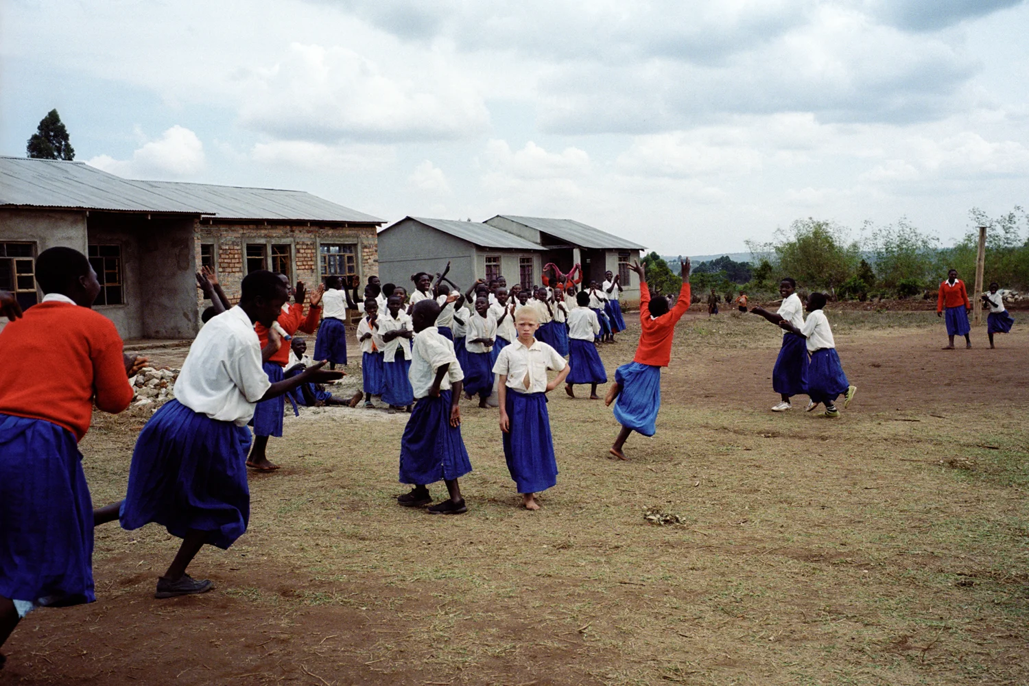 Juliana Tukano plays netball in the afternoon when the sun is less strong. Although she should wear at hat when outside, she doesn't like to, as it is not culturally normal for women to wear hats in Tanzania. Juliana and her brother Adolfu are the only children with albinism at their school. Lugolofu Primary School, Mufindi District, Tanzania. 