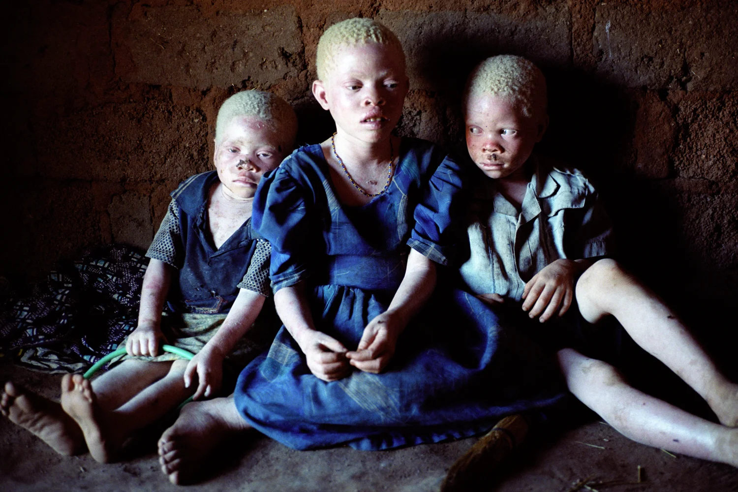 Peruzi, Grace and Jonasi Yanera are from a family of nine children, they are the only ones who have albinism. Due to the recent killings in the area and their remote location they stay hidden in the house when their parents are not home. Mwanza, Tanzania. 
