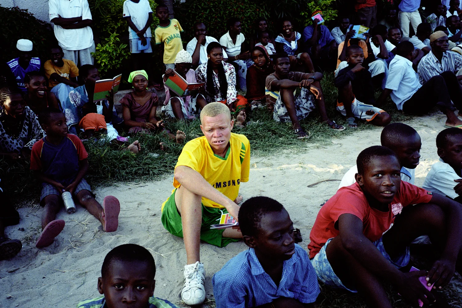 A members of the Albino United football team. Football matches are an opportunity for huge crowds to change their attitudes towards people with albinism when they see them playing and wining - something previously not thought possible. Dar es Salaam, Tanzania. 
