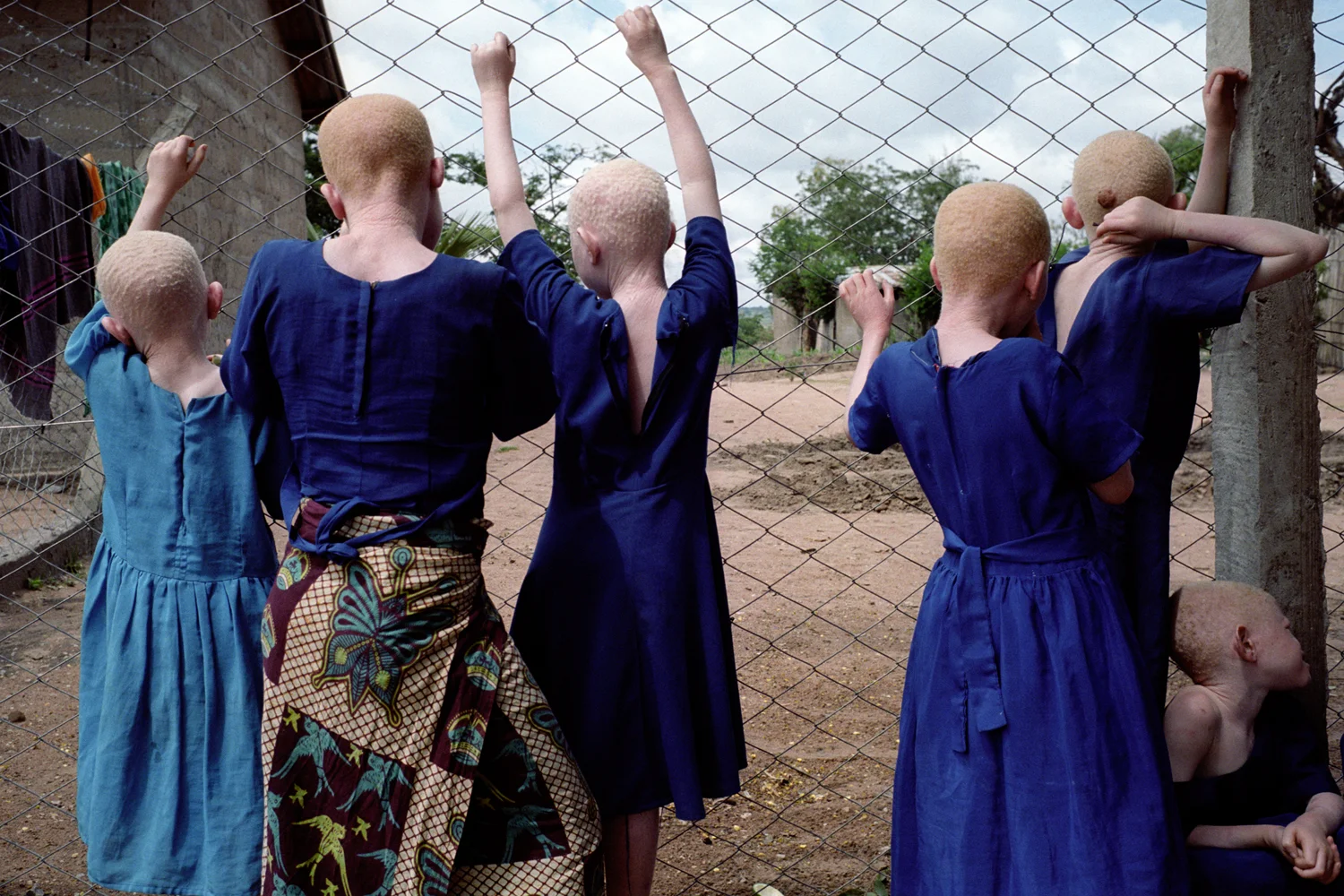 In March 2007, in response to the killings, the Tanzanian government moved all children with albinism in the Mwanza area to Mitindo boarding school feeling it could not properly protect them at home in remote areas. There are 62 children with albinism at the school all of which are being kept in over the holidays for their own safety. Misungwi, Mwanza, Tanzania.