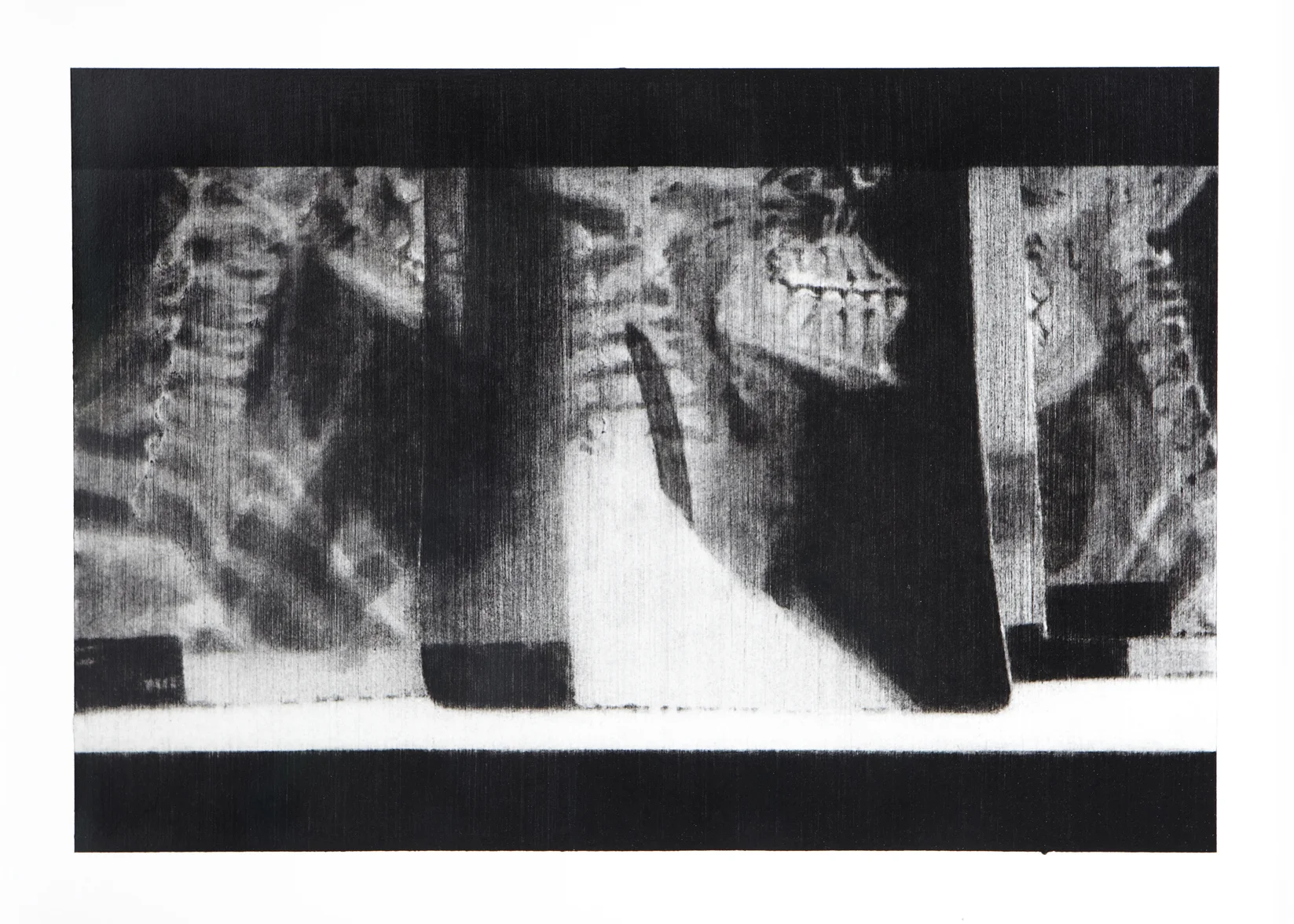 Anterior Laryngial Sac . 2012. Charcoal on paper. 35 x 48cm.