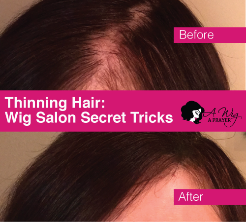 WigHairLossXfusionExample.png