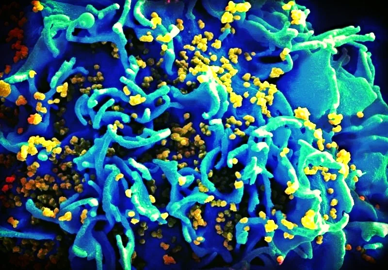 HIV infection of a non-human primate cell