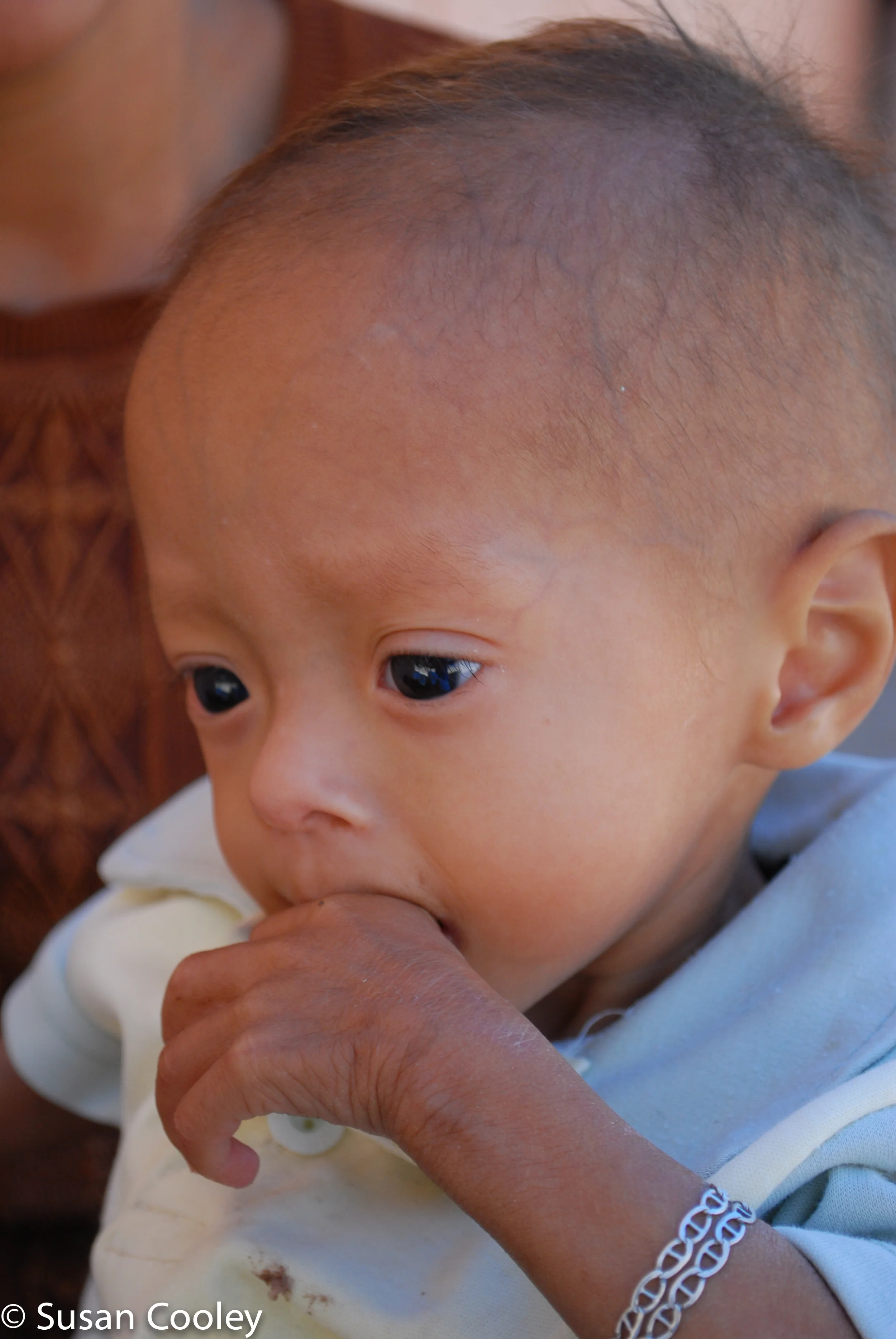 Clinic patient, Guatemala.